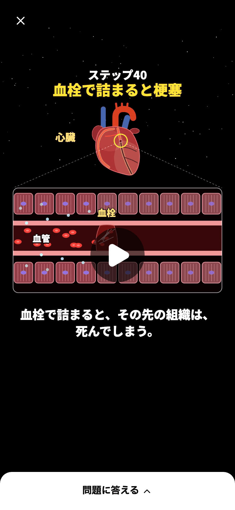 原則の動画の画面。上に「ステップ40 血栓で詰まると梗塞」、心臓から血管の中へ拡大し、血栓が血の流れを止めている絵と、字幕「血栓で詰まると、その先の組織は、死んでしまう。」